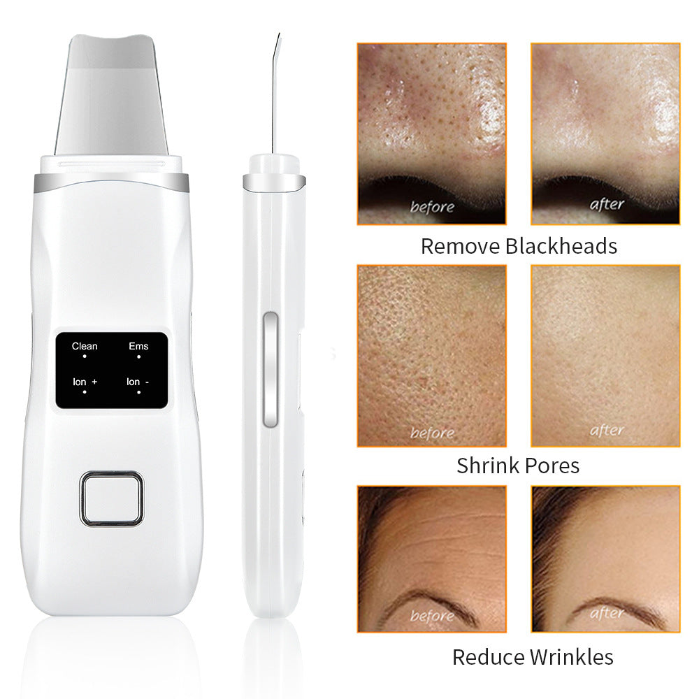 Ultrasonic Peeling Machine HailiCare...