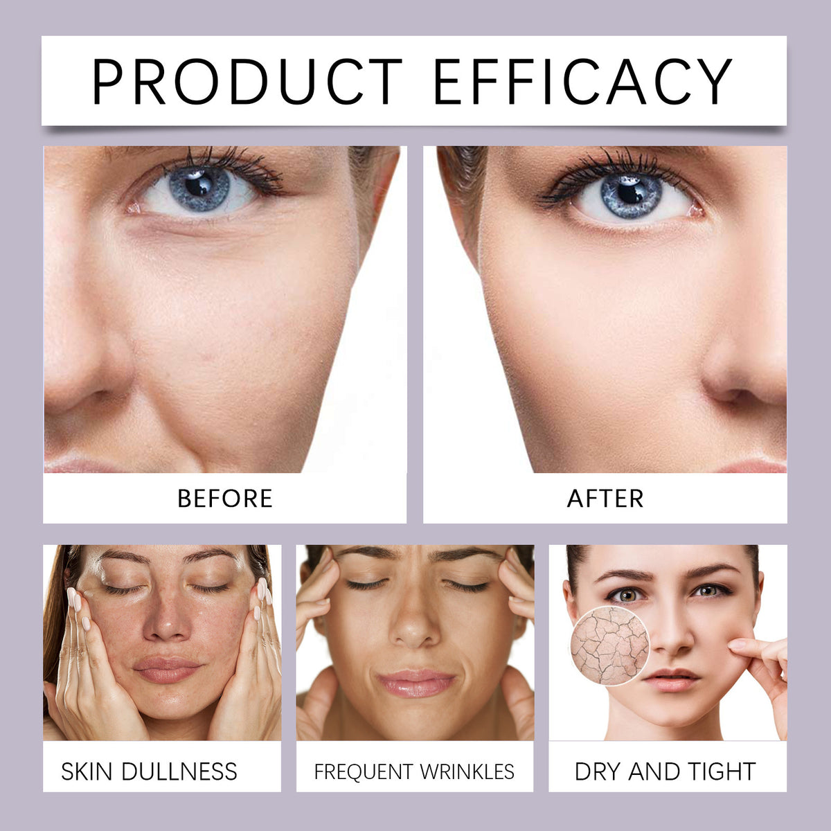 Crema Facial Hidratante Profunda para Suavizar las Líneas de Expresión e Iluminar el Cutis