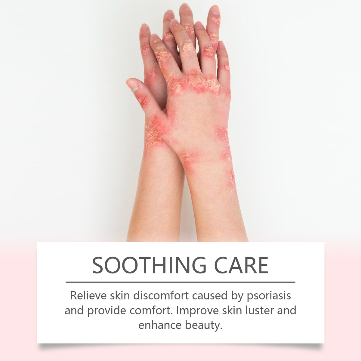 Ximonth Skin Repair Cream: Daily Pamper, Nourish and Improve Skin Comfort with a Moisturizing Cream for the Body